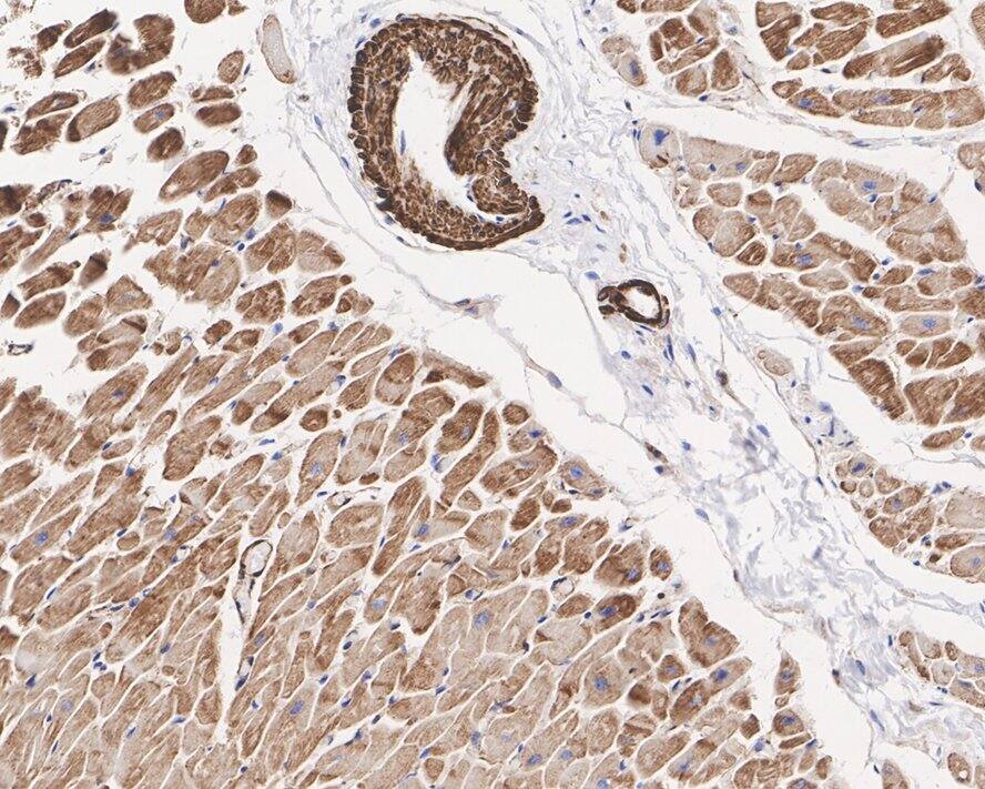 pan Actin Antibody (A2E1-R)