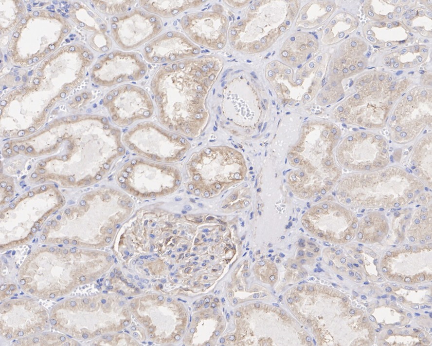 Pannexin-1 Antibody (JE38-97)