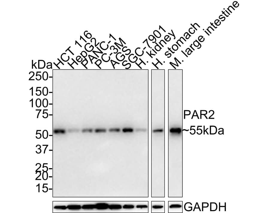 PAR2 Antibody (JE35-05)