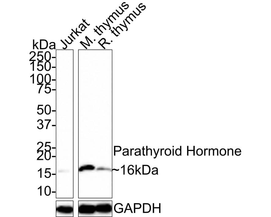 PTH Antibody (JE31-67)