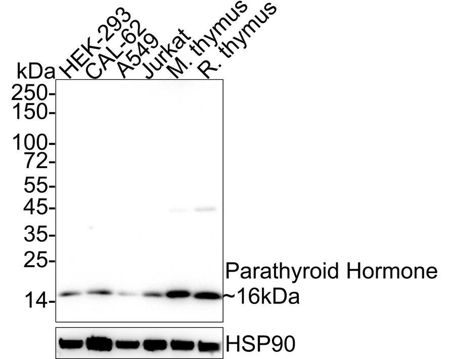 PTH Antibody (JE66-58)