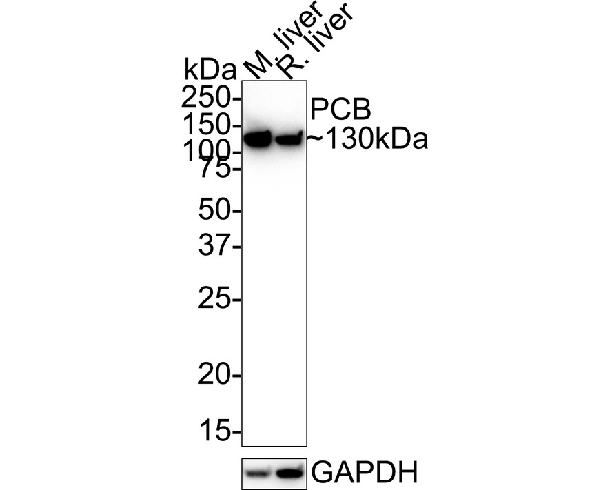 Pyruvate Carboxylase Antibody (JE40-24)