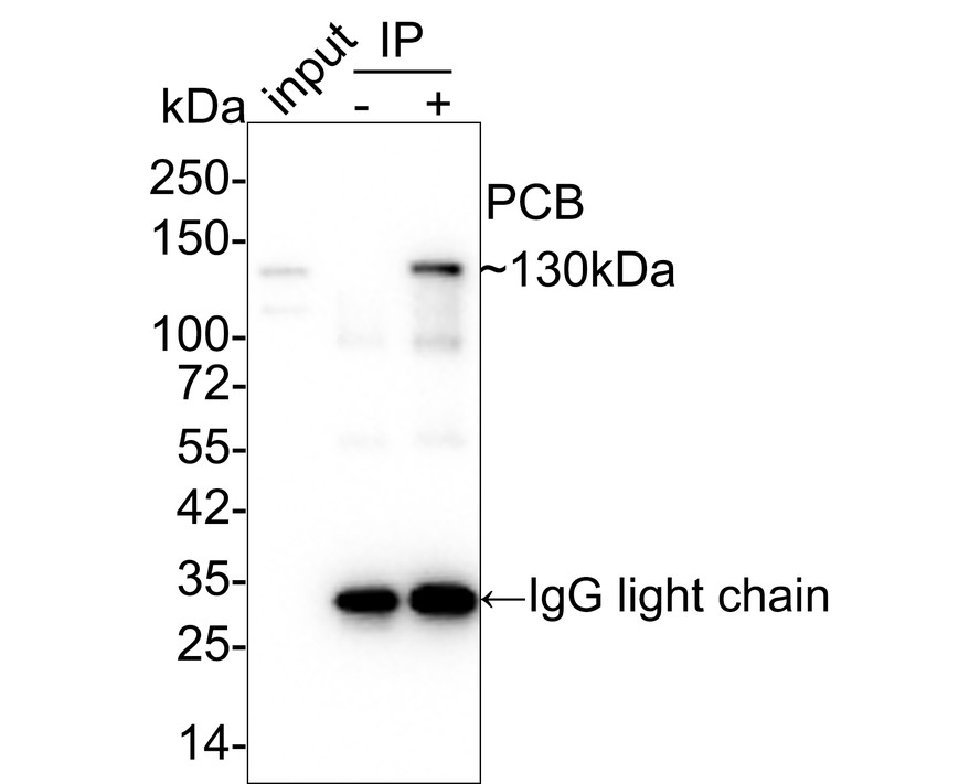 Pyruvate Carboxylase Antibody (PSH01-55)