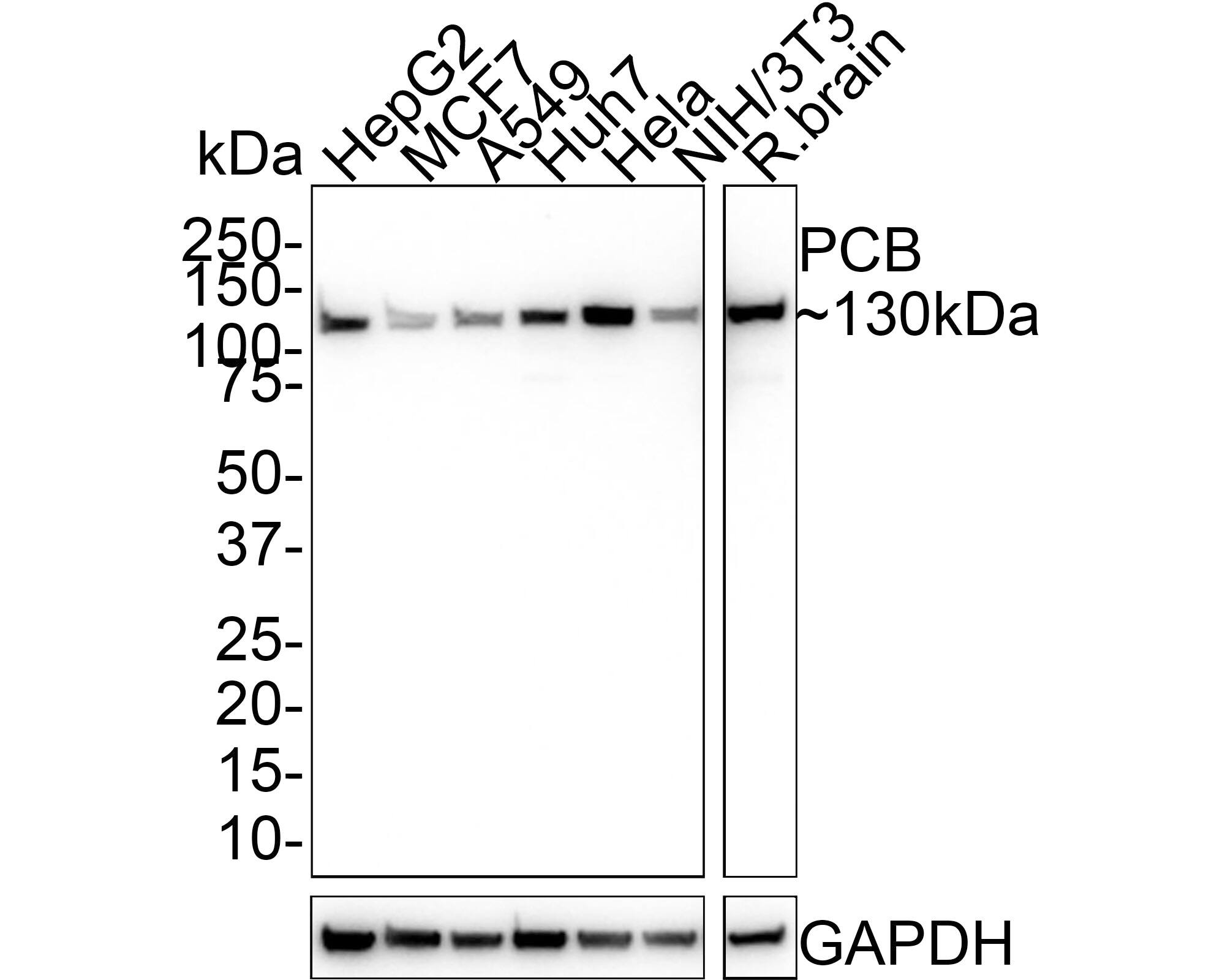 Pyruvate Carboxylase Antibody (PSH01-55)