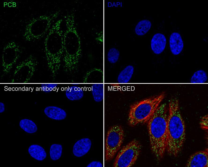 Pyruvate Carboxylase Antibody (PSH01-55)