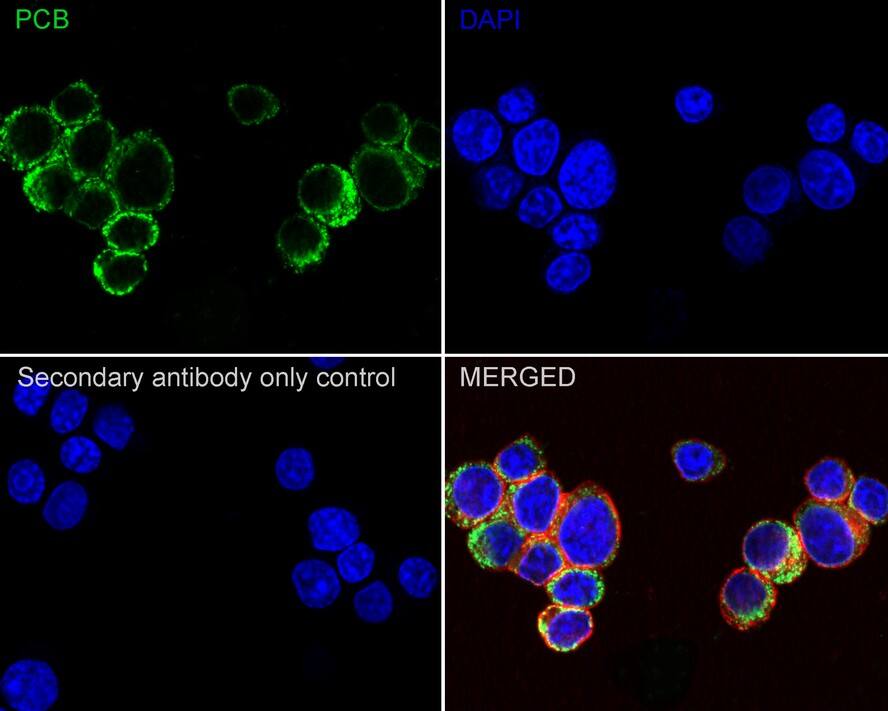 Pyruvate Carboxylase Antibody (PSH01-56)