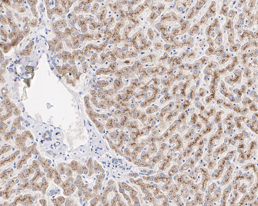 Pyruvate Carboxylase Antibody (PSH01-56)