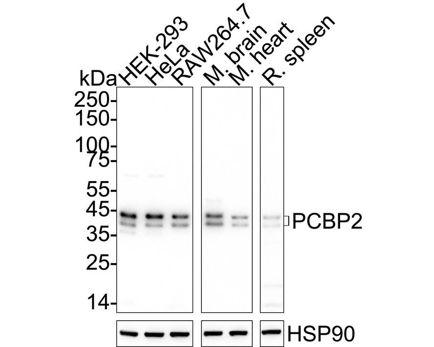 PCBP2 Antibody (JE65-05) Western Blot: PCBP2 Antibody (JE65-05) [NBP3-32724]