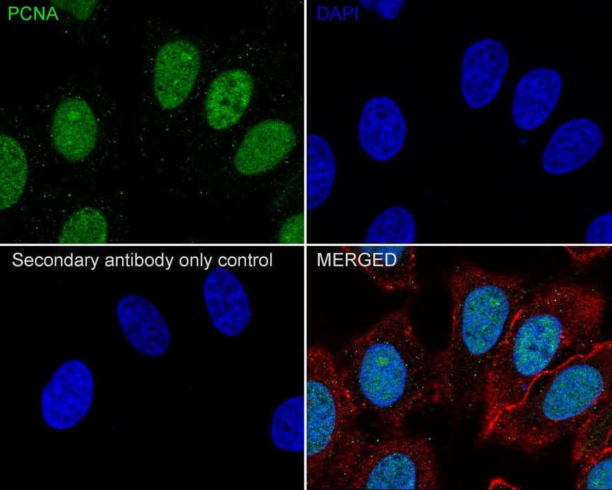PCNA Antibody (A6-G11-R)