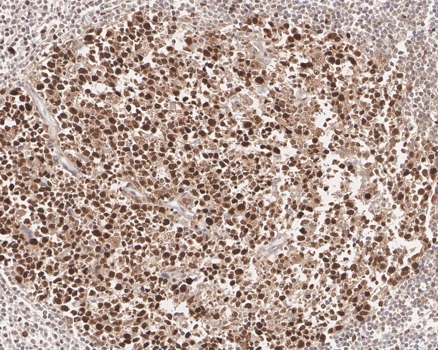 PCNA Antibody (A6-G11-R)