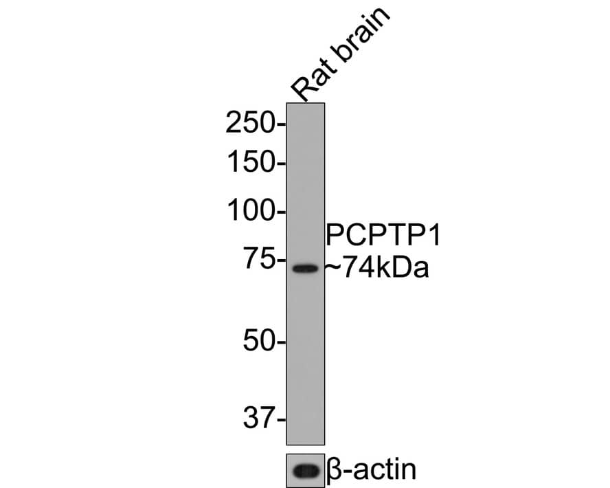 PCPTP1 Antibody (JE64-84)