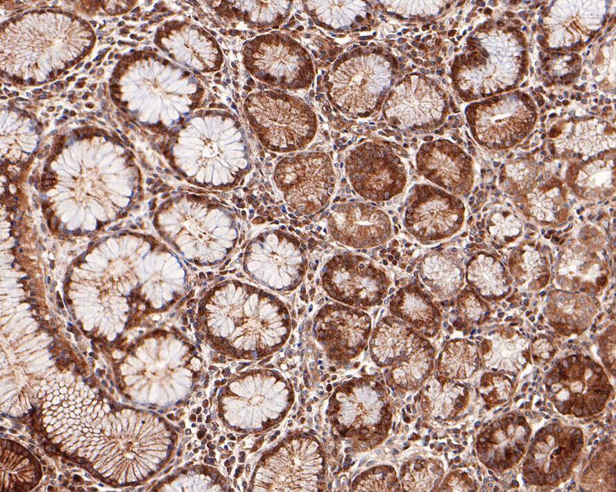 PCPTP1 Antibody (JE64-84)