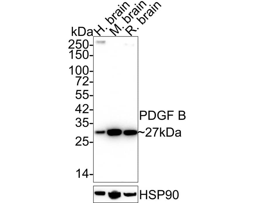 PDGF-B Antibody (JE75-16)