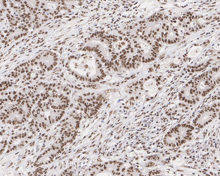 PELP1 Antibody (JE02-42)