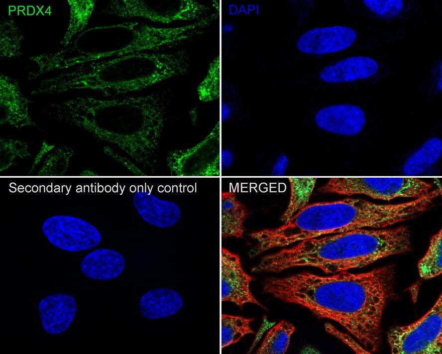 Peroxiredoxin 4 Antibody (PSH03-40)