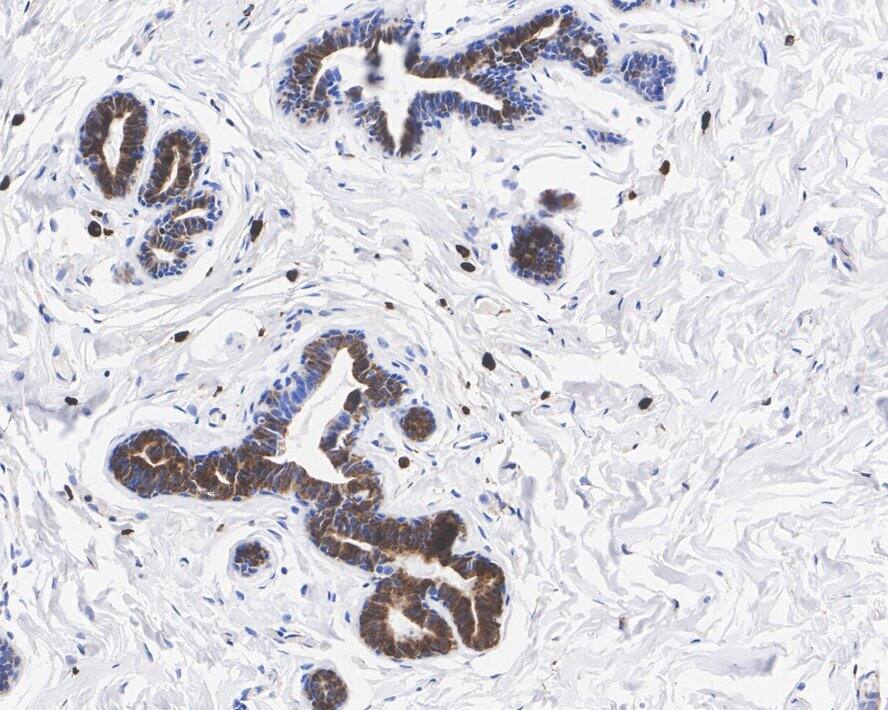 Peroxiredoxin 4 Antibody (PSH03-40)