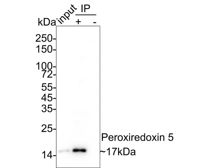 Peroxiredoxin 5 Antibody (PSH03-90)