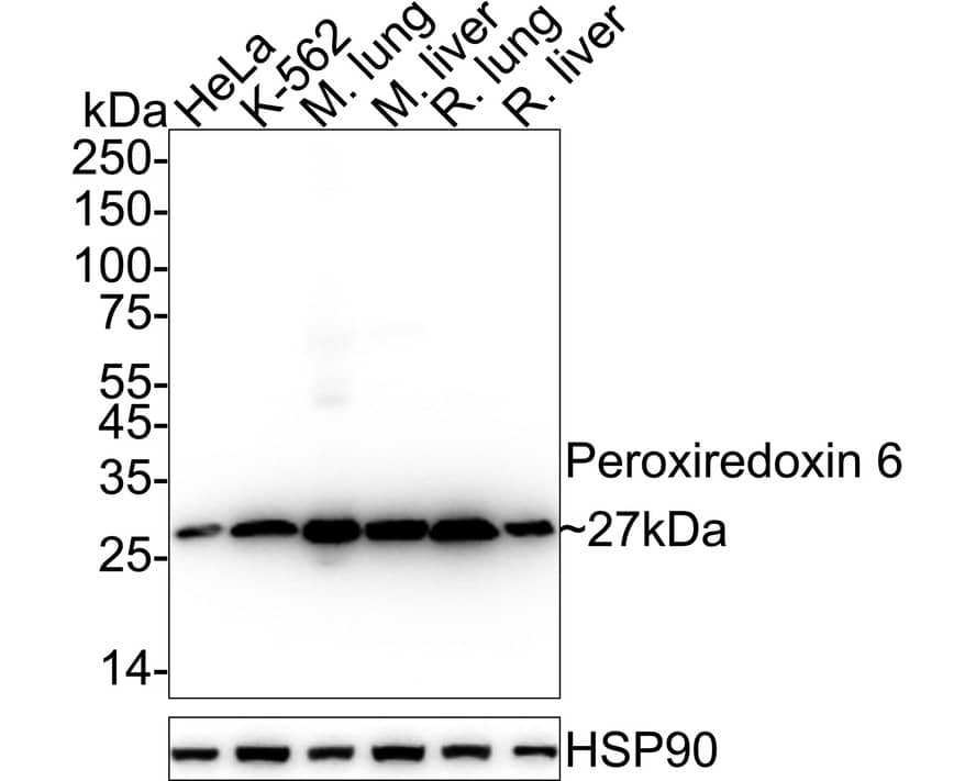 Peroxiredoxin 6 Antibody (7G1-R) Western Blot: Peroxiredoxin 6 Antibody (7G1-R) [NBP3-32741]
