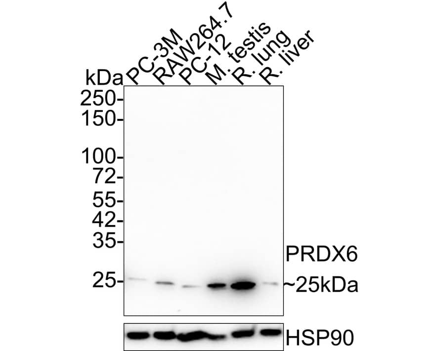 Peroxiredoxin 6 Antibody (7G1-R)