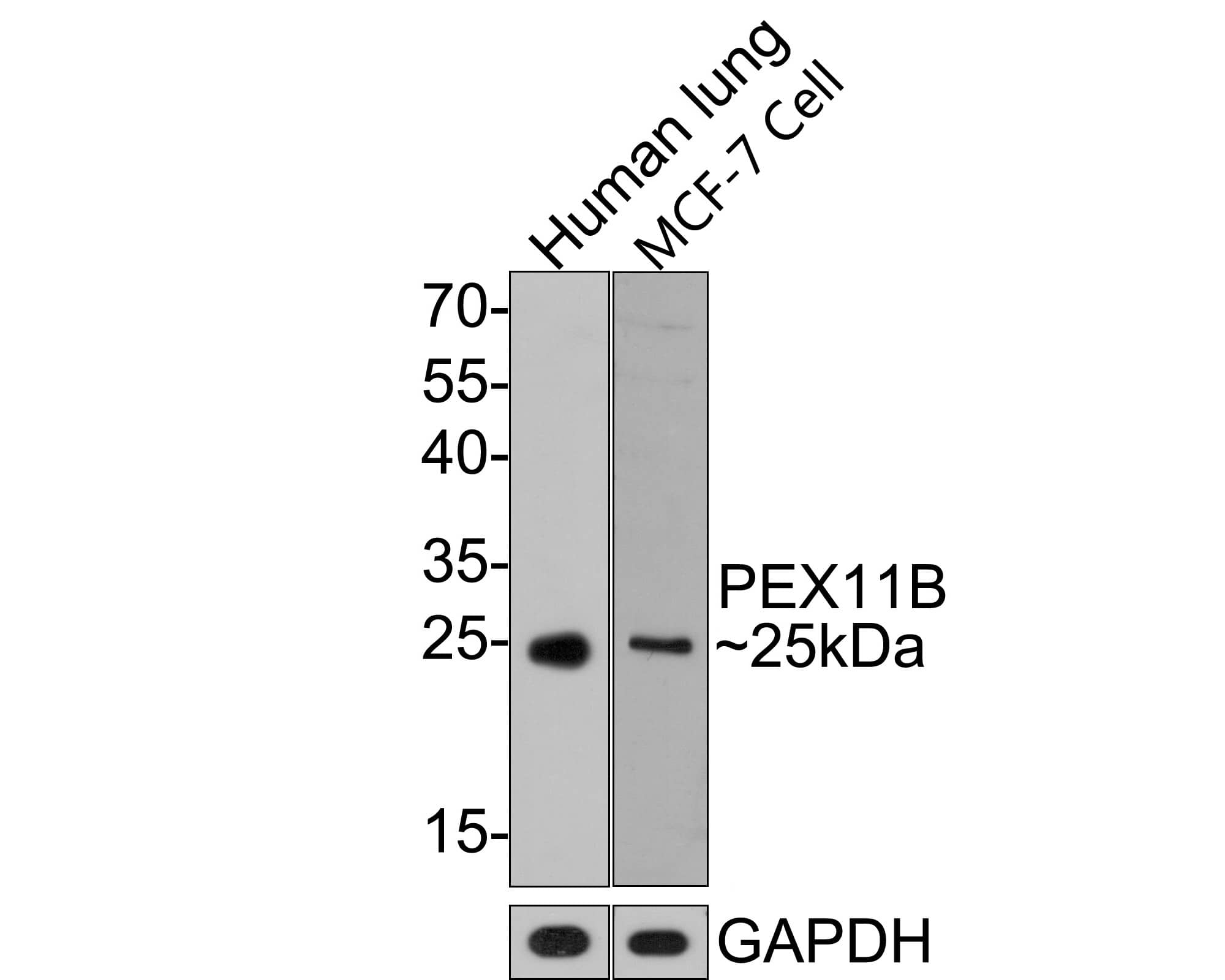 PEX11B Antibody (JE64-51)