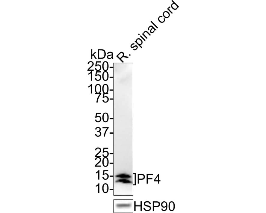 CXCL4/PF4 Antibody (JE31-48)