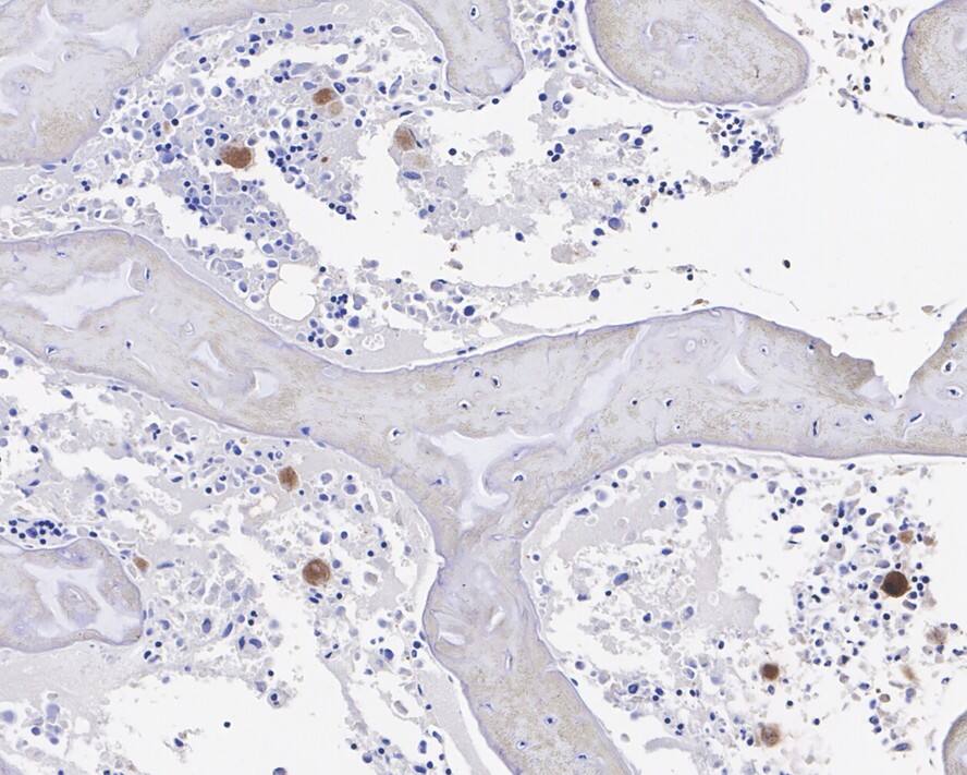 CXCL4/PF4 Antibody (JE31-48)