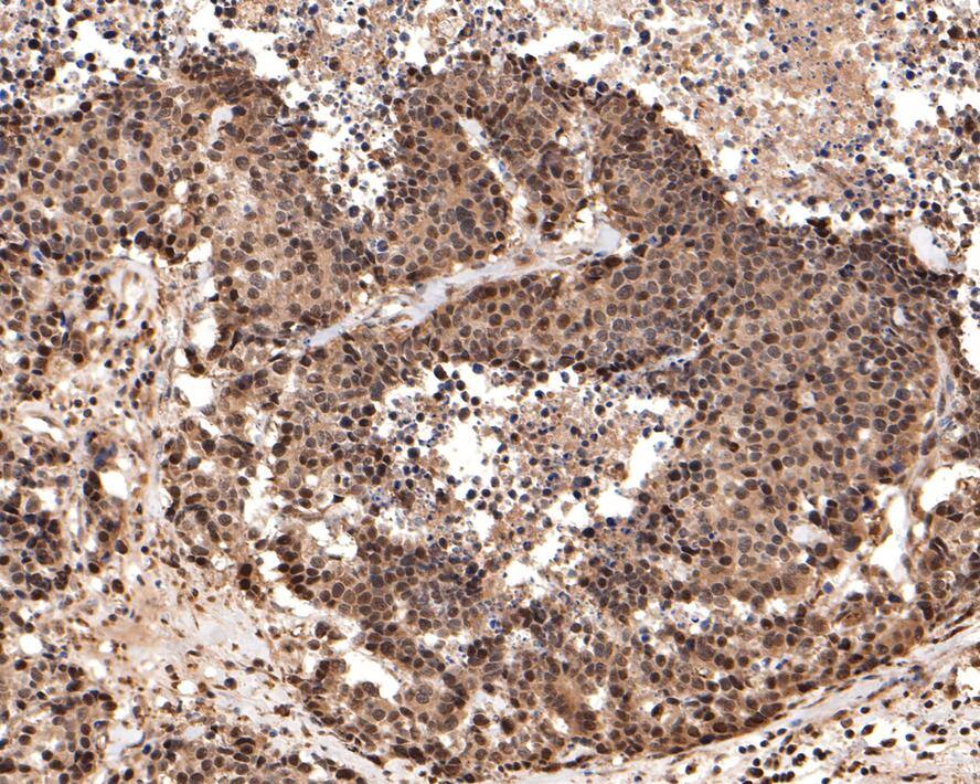 PGBD5 Antibody