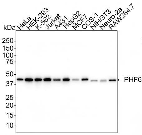 PHF6 Antibody (PSH02-35) Western Blot: PHF6 Antibody (PSH02-35) [NBP3-32746]