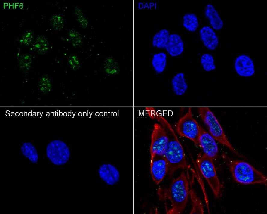 PHF6 Antibody (PSH02-35)