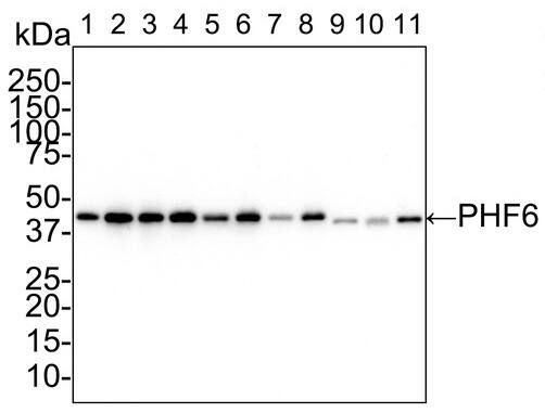 PHF6 Antibody (PSH02-35)