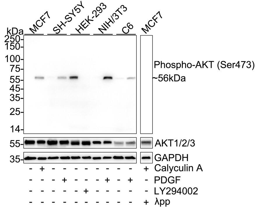 AKT [p Ser473] Antibody (PSH04-44) Western Blot: AKT [p Ser473] Antibody (PSH04-44) [NBP3-32747]