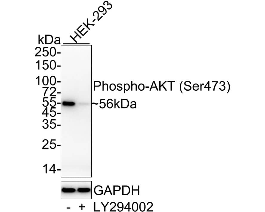 AKT [p Ser473] Antibody (PSH04-44)