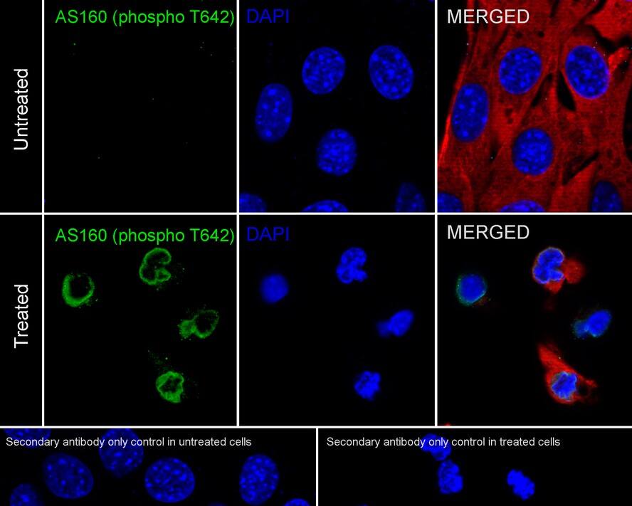 TBC1D4 [p Thr642] Antibody (JE60-97)