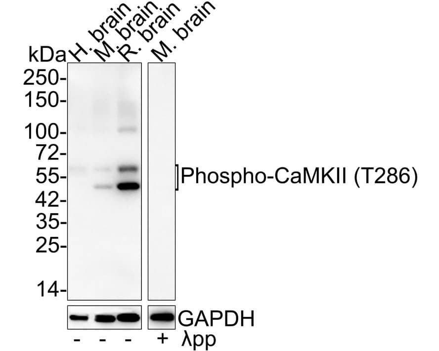 CaM Kinase II [p Thr286] Antibody (JE51-81)