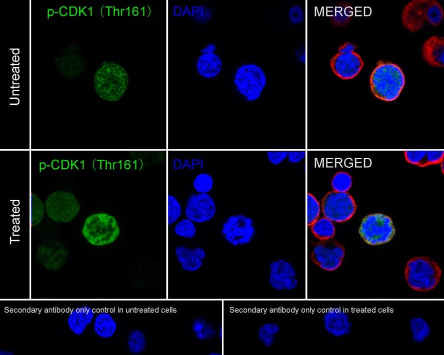 CDC2/CDK1 [p Thr161] Antibody (PSH03-42)