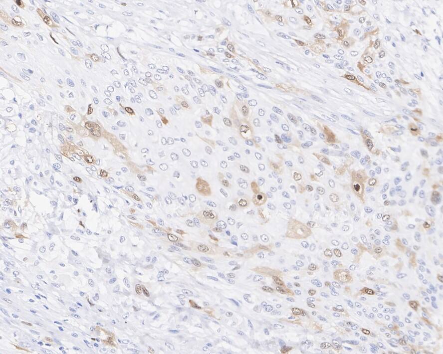 CDC2/CDK1 [p Thr161] Antibody (PSH03-42)