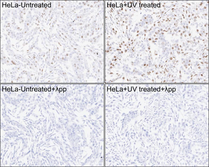 Chk1 [p Ser317] Antibody (PSH03-84)