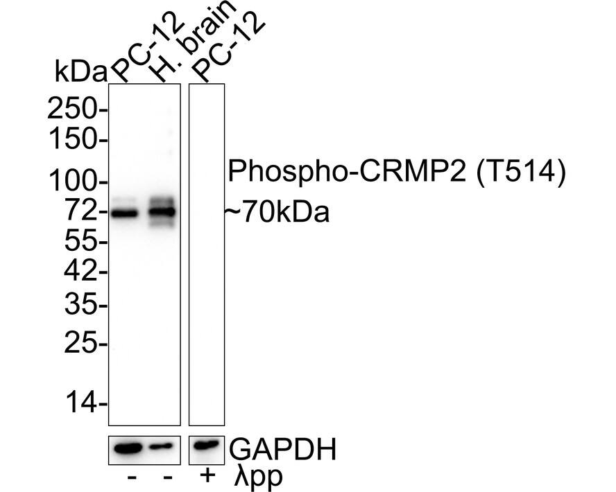 CRMP2 [p Thr514] Antibody (JE57-25)