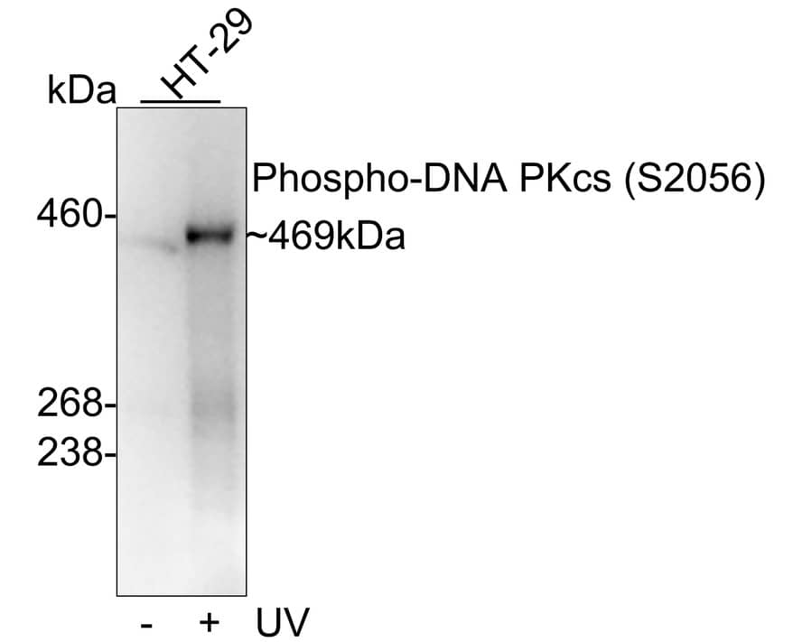 DNA-PKcs [p Ser2056] Antibody (JE41-92)