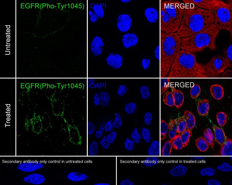 EGFR [p Tyr1045] Antibody (PSH03-28)