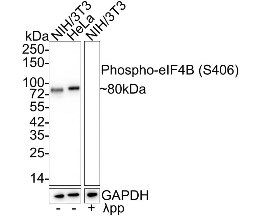 eIF4B [p Ser406] Antibody (JE58-32)