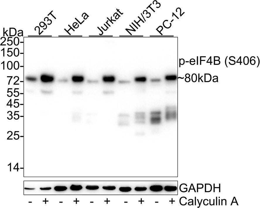 eIF4B [p Ser406] Antibody (JE63-80)