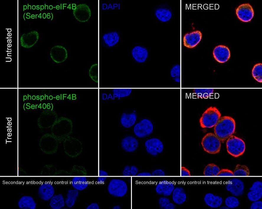 eIF4B [p Ser406] Antibody (JE63-80)