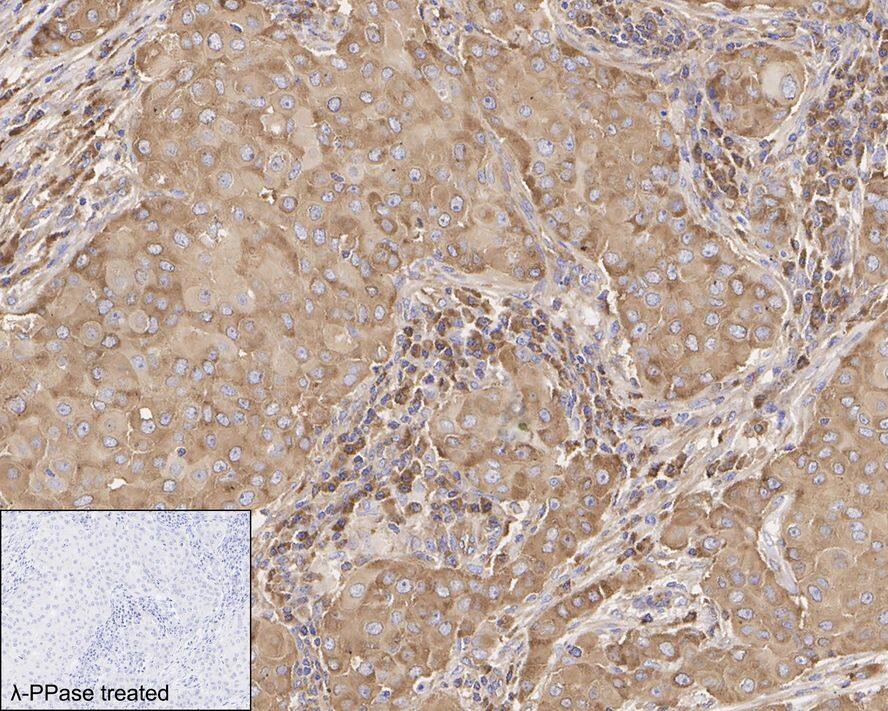 eIF4B [p Ser406] Antibody (JE63-80)