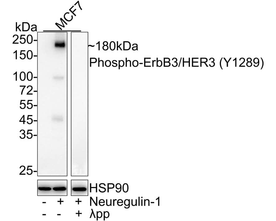 ErbB3/Her3 [p Tyr1289] Antibody (JE51-25)