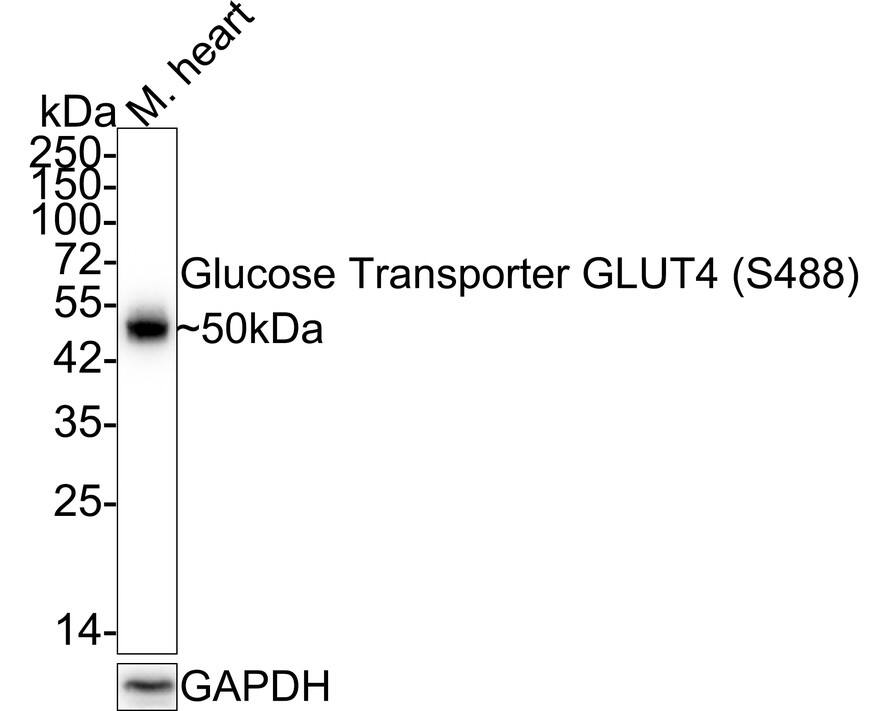 Glut4 [p Ser488] Antibody (JE43-23) Western Blot: Glut4 [p Ser488] Antibody (JE43-23) [NBP3-32766]