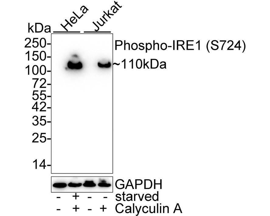 IRE1 [p Ser724] Antibody (PSH03-35)