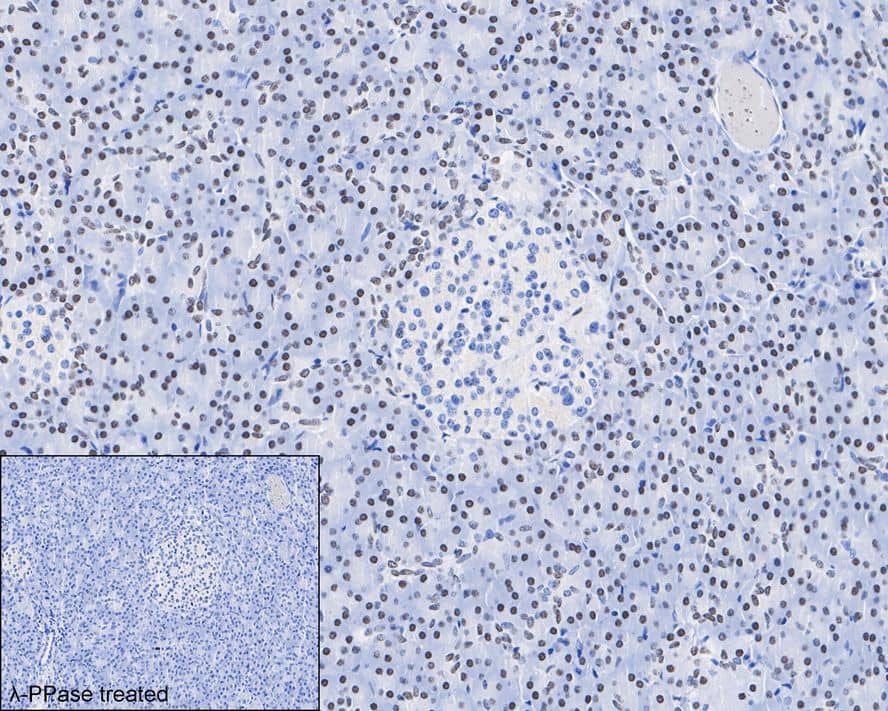 IRE1 [p Ser724] Antibody (PSH03-35)