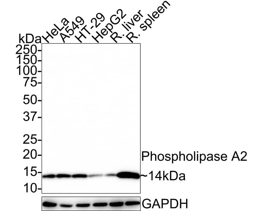 PLA2G2A Antibody (JE41-02)