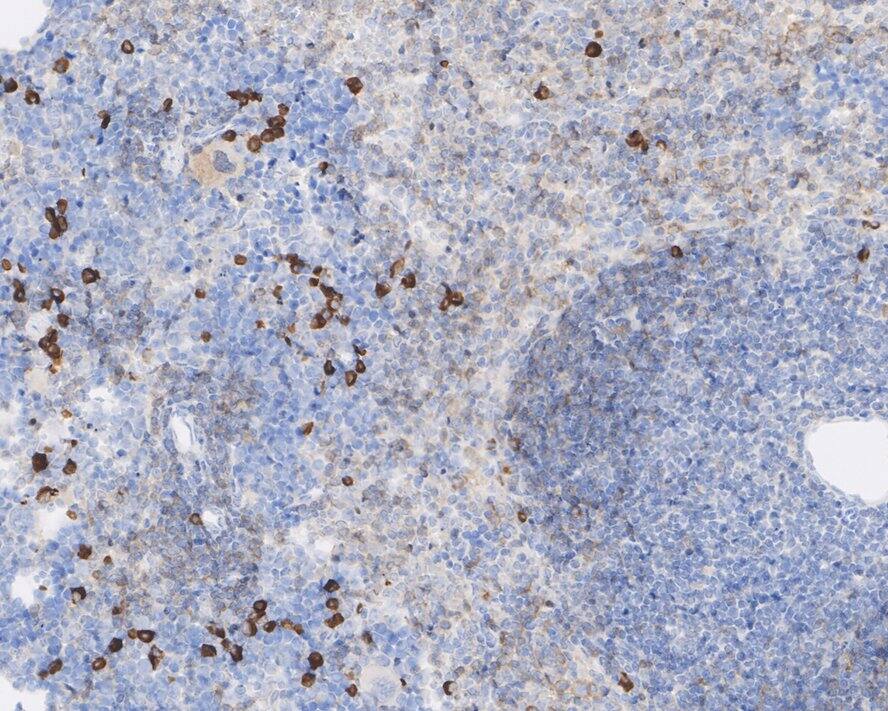 PLA2G2A Antibody (JE41-02)